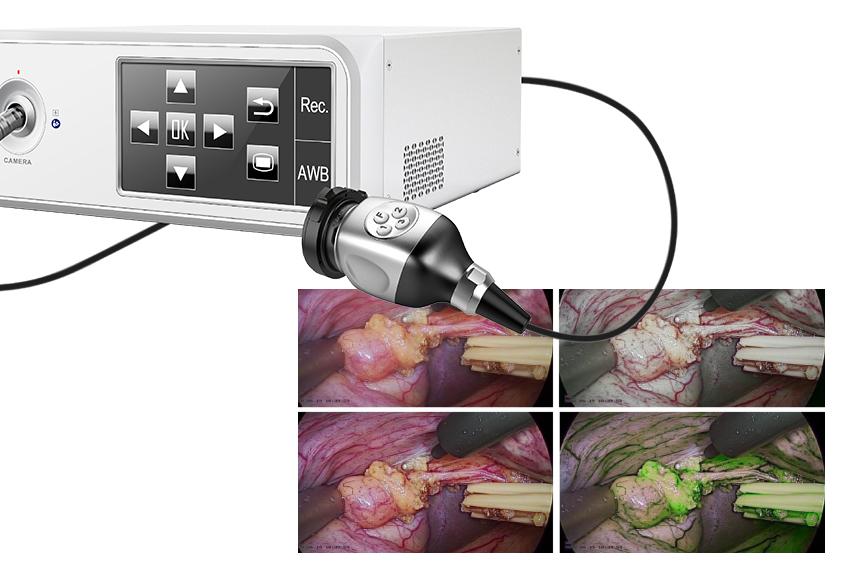 Endoscopy Camera Unit